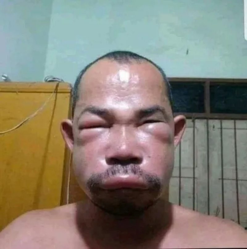 Meme Thiểu Năng