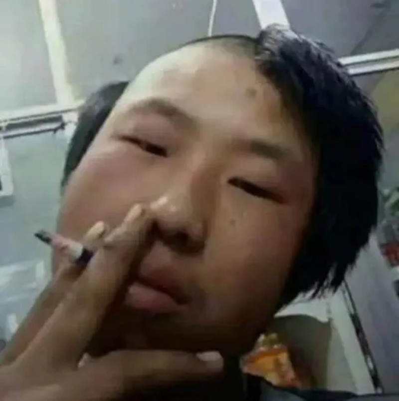 Meme Thiểu Năng