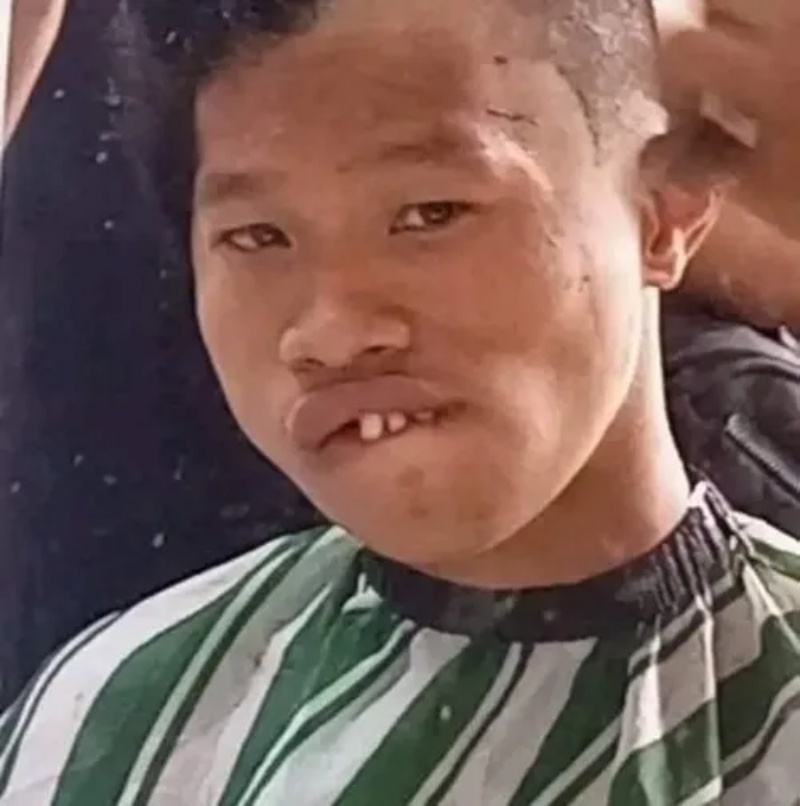 Meme Thiểu Năng